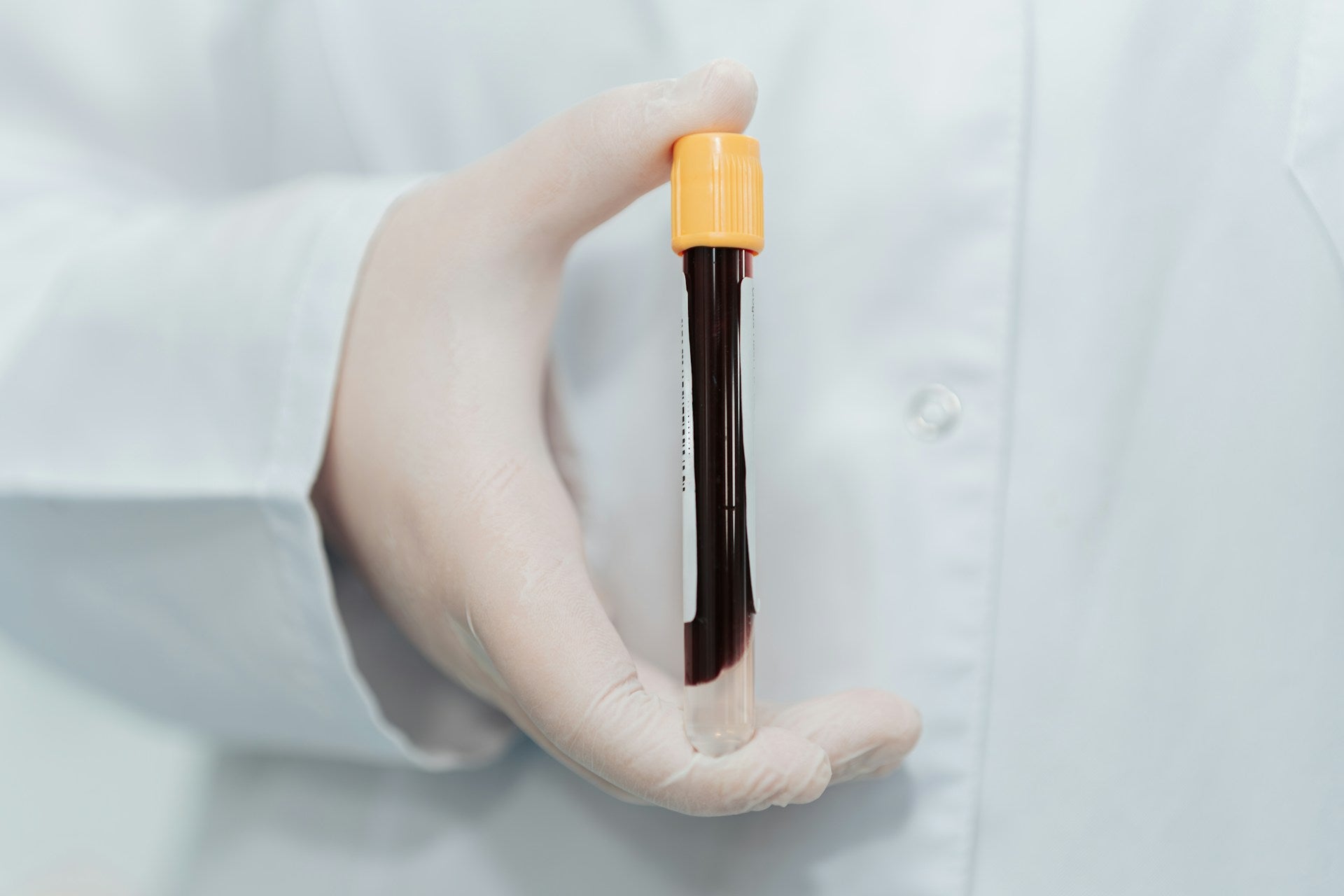 Blood Profile Test