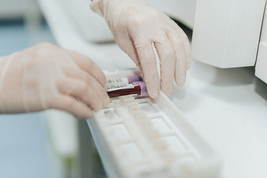 Making Sense of Your Blood Profile Test Results - Leyton Pharmacy