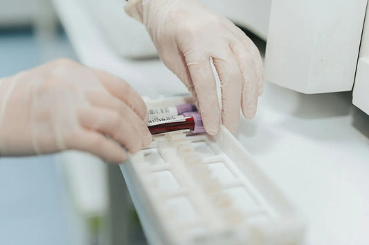 Making Sense of Your Blood Profile Test Results - Leyton Pharmacy